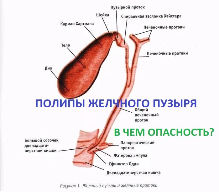 Лечение полипов желчного пузыря