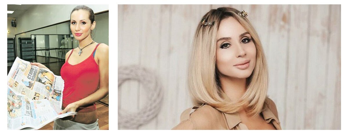 В сравнении видно, насколько гармоничнее лицо на правой фотографии.