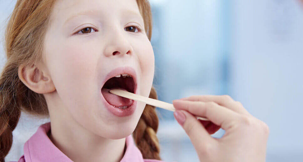 Сегодня мы поговорим о таком воспалительном заболевании, как АНГИНА. Прежде чем перейти к разговору о симптомах, лечении и профилактики, давайте же выясним что же такое ангина.
Ангина - острое воспалительное заболевание инфекционной природы. Органами-мишенями являются лимфатические узлы глоточного канальца, чаще – миндалины.
Что же может послужить причиной развития данного заболевания.
Во-первых, заражение может произойти при контакте с больным человеком воздушно – капельным путем или при попадании возбудителей в миндалины из других очагов.
Во – вторых, вызывается стафилококками и стрептококками.
Симптомы.
-высокая температура тела-39-40 °C-4-5 дней.
-головная боль, общая слабость.
-сильная и резкая боль в горле, усиливающаяся при глотании.
-увеличение лимфатических узлов, которые прощупываются под нижней челюстью ближе к шее.
Лечение.
Помните, что ни в коем случае, не стоит заниматься самолечением, так как это может только ухудшить ваше состояние. Обязательно дождитесь и выслушайте рекомендации врача.
Но облегчить боль при ангине и быстрее выздороветь вам помогут именно эти советы:
-пейте теплый чай из ромашки. Он обладает антибактериальным действием, снимает боль и дискомфорт в горле.
-делайте полоскание 2-3 раза в день. В 1 стакане теплой воды следует растворить одну таблетку фурацилина или 1 чайную ложку соды.
-запомните! Смазывать миндалины нельзя, так как есть риск поцарапать. В таком случае бактерии попадают в кровь. Возникает угроза осложнений на сердце и почки.
-нельзя лечиться молоком, медом и сливочным маслом. Напиток на миндалинах создает пленку. Возбудители ангины будут размножаться. Состояние ухудшиться.
Признаки ангины:
-покраснение горла.
-воспаленный язычёк.
-увеличенные и красные миндалины.
-серый налет на языке.
-гнойные пробки в миндалинах.
Профилактика:
-Своевременная санация очагов хронического воспаления. Включая лечение кариозных зубов.
-Ну и конечно соблюдение личной гигиены, изоляция от остальных членов семьи.
Помните, что наше здоровье во многом зависит от нас самих. Берегите себя! Всего вам самого доброго. Ну и конечно же будьте здоровы!

