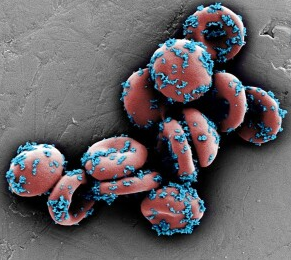 Наночастицы, заполненные лекарством от рака (синего цвета), прилипают к эритроцитам мыши (сканирующая электронная микрофотография, окрашенная).