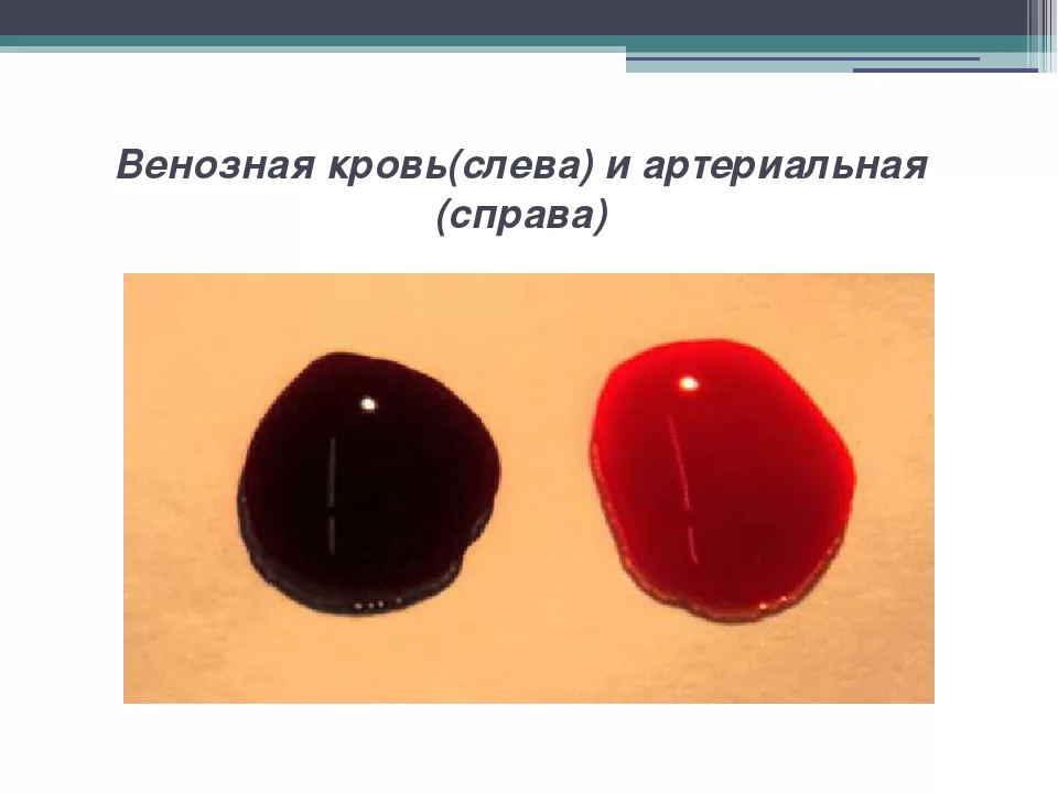 Кровь из вены какого цвета: найдено 89 картинок