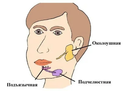 Что делать при воспалении слюнных желез у взрослых и детей - стоматологический блог Sirius-Dent