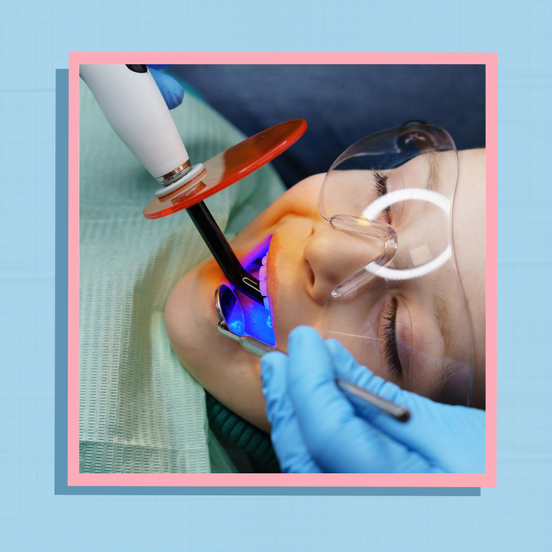 Светополимерные пломбы в Оренбурге