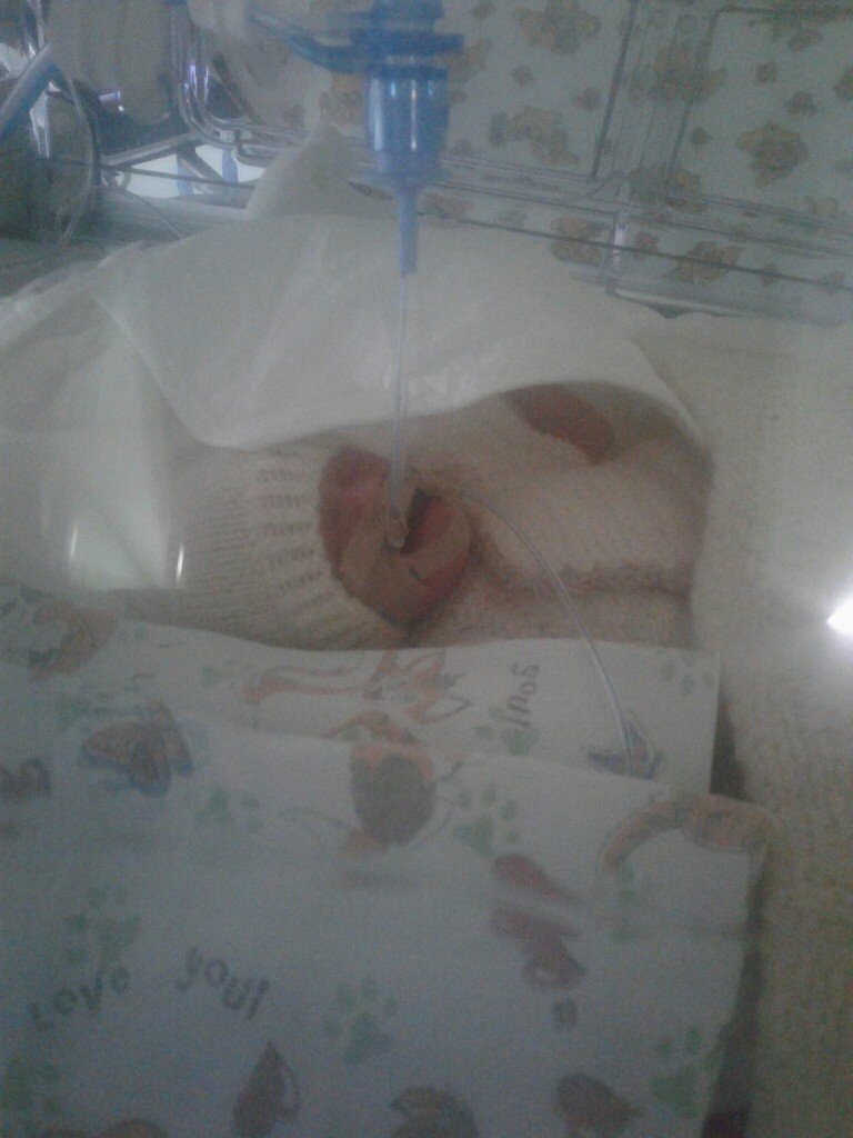 Извините за качество фотографии. На фото моя девочка. Здесь ей меньше суток.