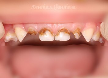 Яндекс картинки 