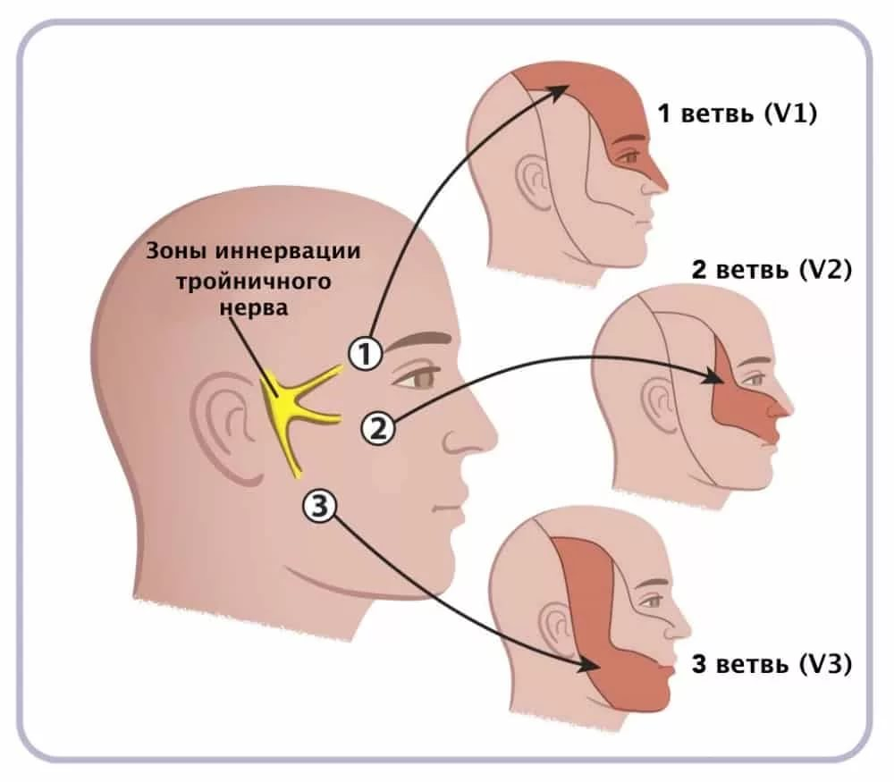 Воспаление тройничного нерва. То, что поможет в лечении | Evolutis Clinic |  Дзен