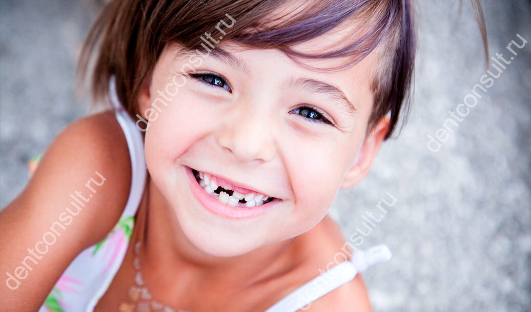 Как меняются молочные зубы на постоянные. Фото: dentconsult.ru