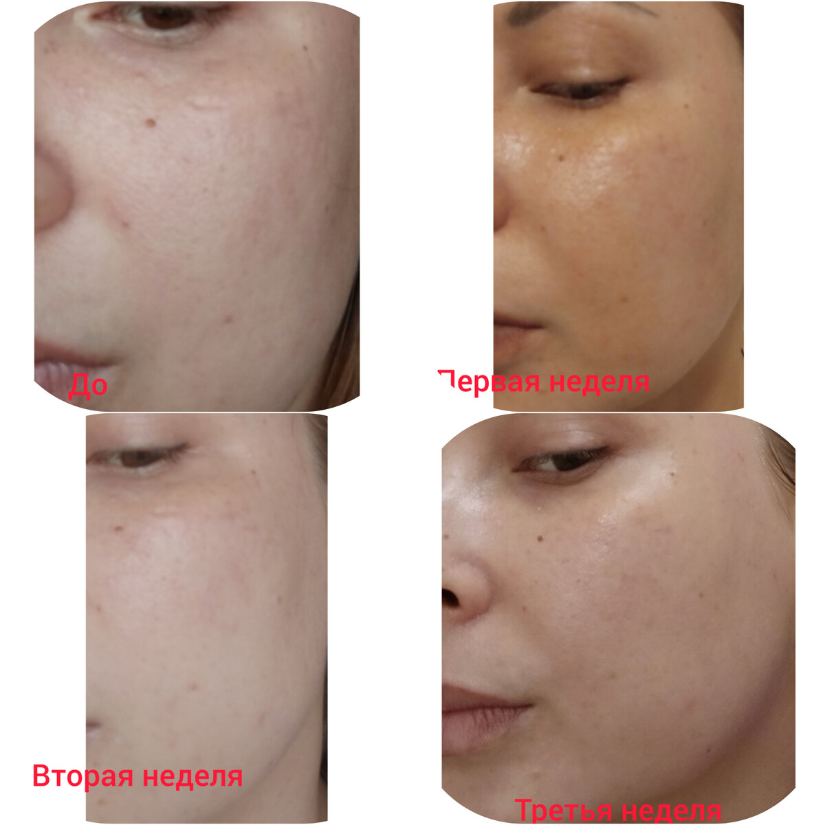 На фото все этапы (по 2 применения в неделю). 