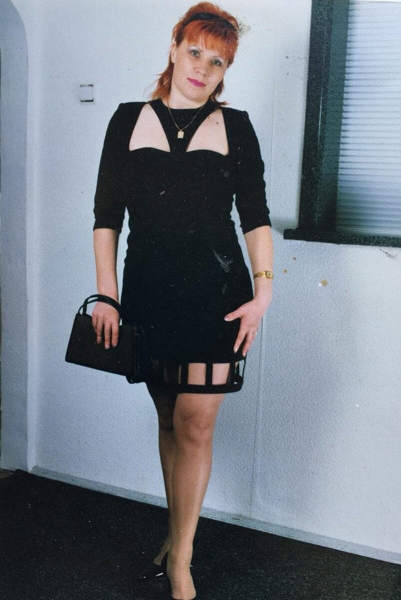 Это я спустя 2года после похудения мне 35