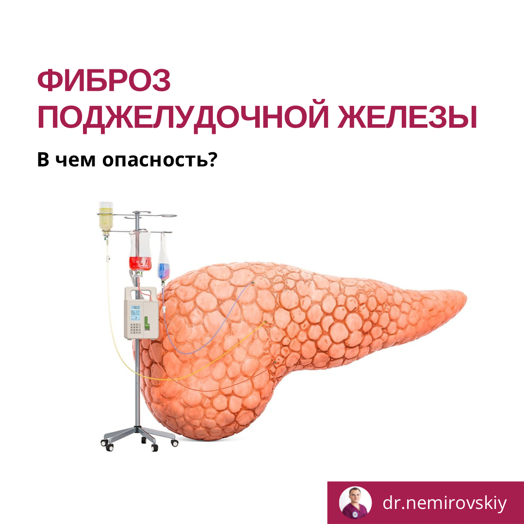 Фиброз поджелудочной железы . В чем опасность? | Висцеральный массаж ...