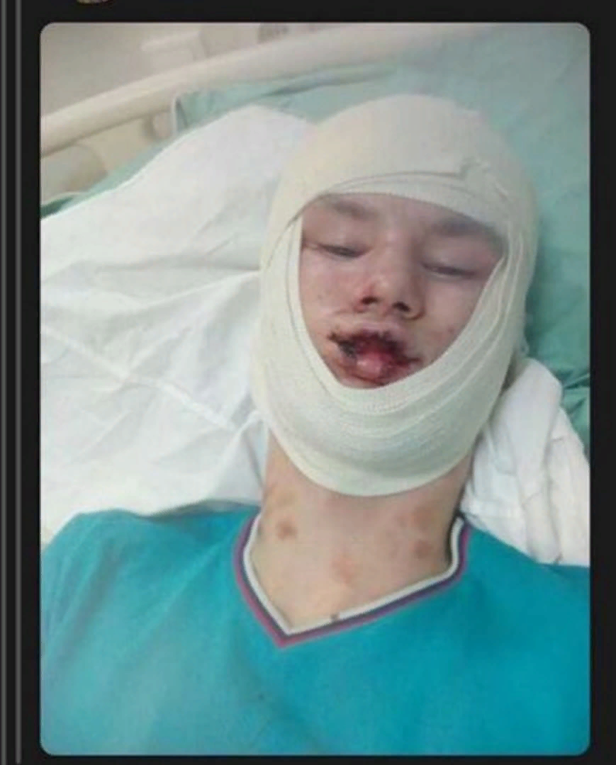 Избитый парень не хочет писать заявление, а только "отомстить"