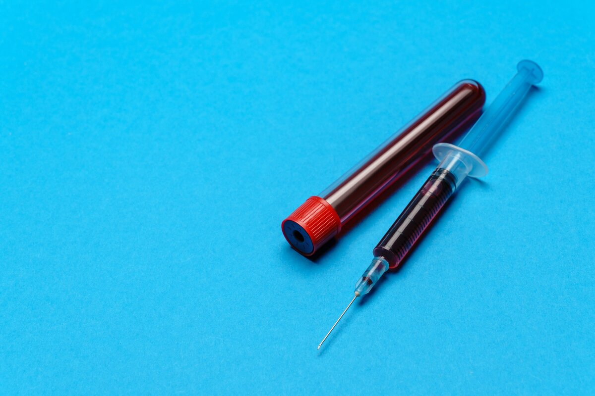 Темная кровь - к болезням.