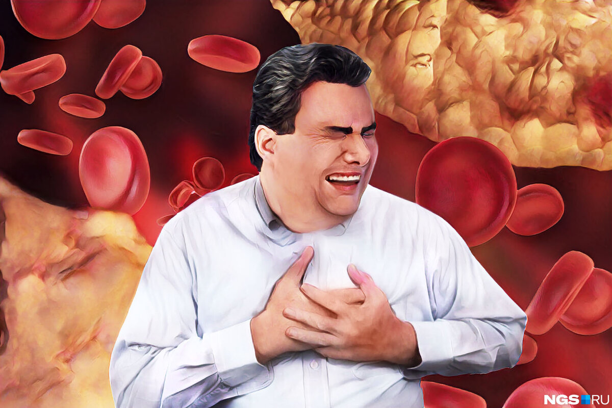     К накоплению плохого холестерина приводят малоподвижный образ жизни, отсутствие регулярной физической нагрузки на свежем воздухе, переедание    
 Иллюстрация: Юрий Орлов / Городские порталы