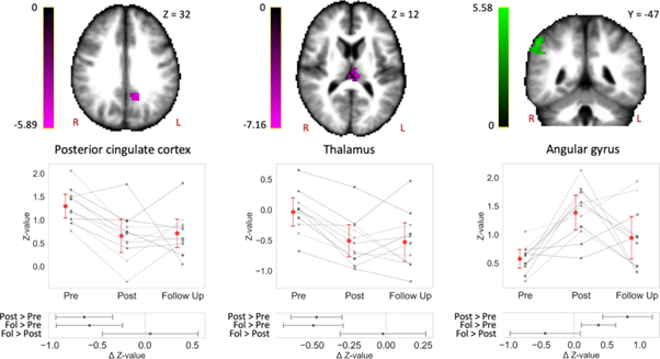    Метод фМРТ позволяет визуализировать активность мозга как в состоянии покоя, так и во время выполнения определенных задач. Когда определенный участок активирован, обмен веществ в нем становится более интенсивным, и приток крови к нему увеличивается. Эти изменения и фиксирует фМРТ / ©Пресс-служба НИУ ВШЭ