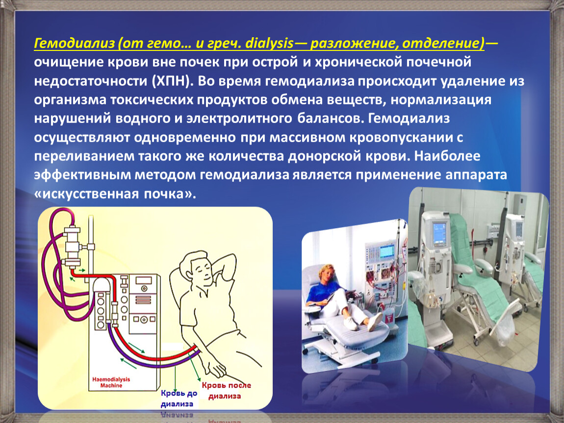 Физиология оборудование. Принцип гемодиализа почек. Аппарат гемодиализа. Аппарат искусственная почка. Гемодиализ методика проведения.