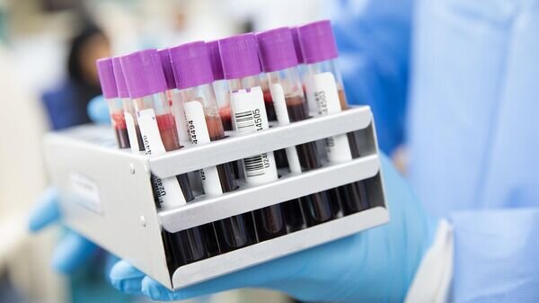    © Photo : Pixabay / AhmadArdity