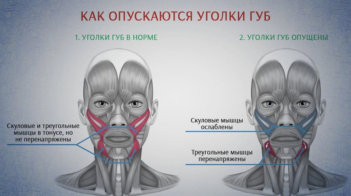 Пример образования мимических морщин в уголках губ