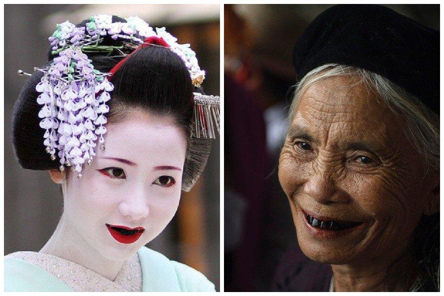 Черные зубы