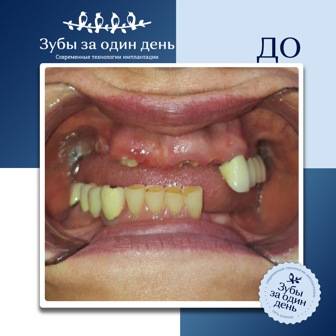 фото сети клиник "зубы за 1 день"