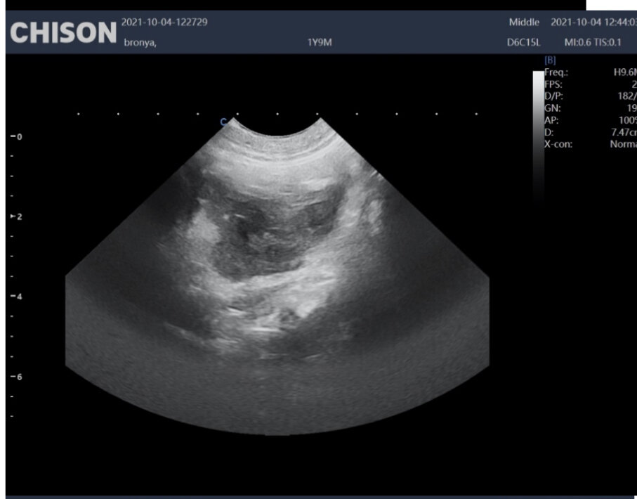 Структура в области левого яичника