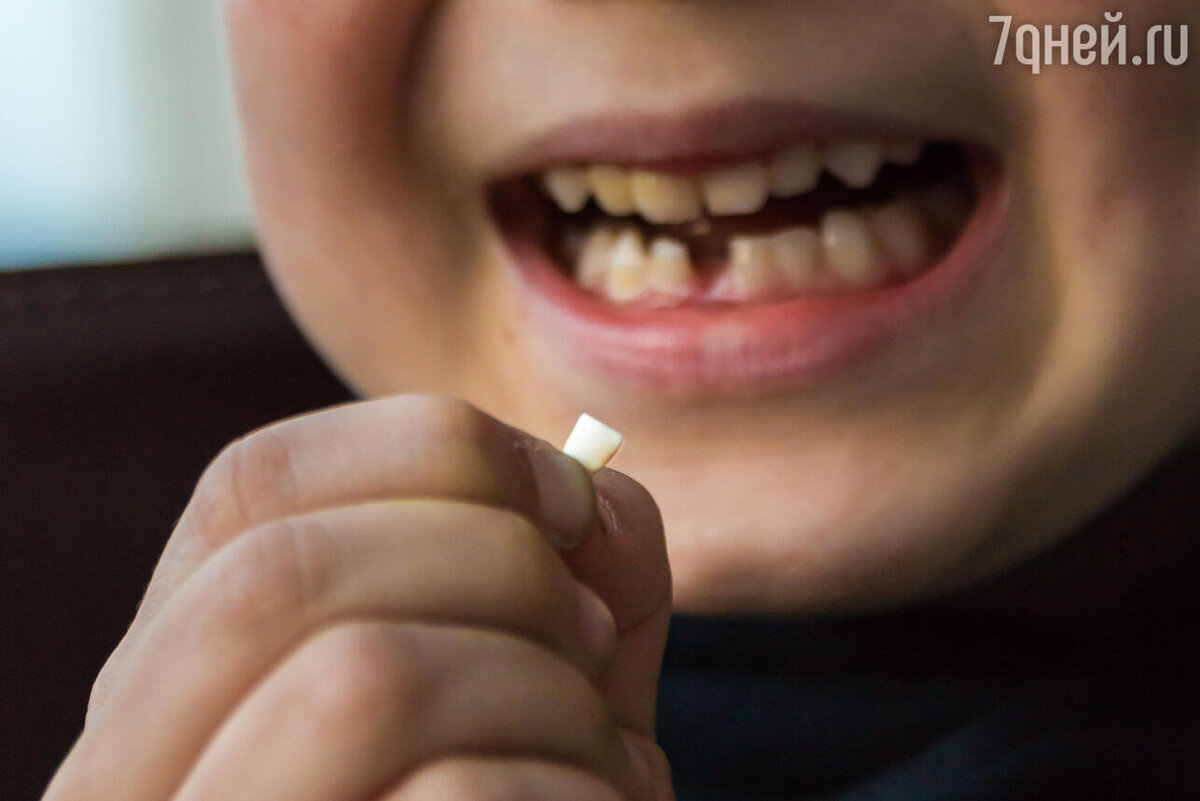    К чему снятся выпавшие зубы 123RF/legion-media.ru