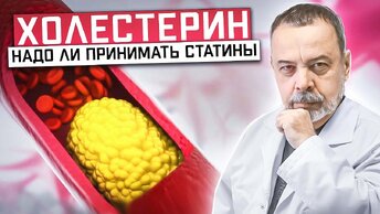 ХОЛЕСТЕРИН Надо ли принимать статины? / холестерин / как нормализовать холестерин / Статины /