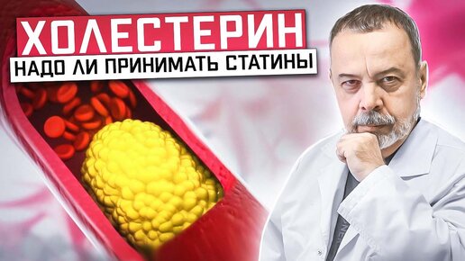 Video herunterladen: ХОЛЕСТЕРИН Надо ли принимать статины? / холестерин / как нормализовать холестерин / Статины /