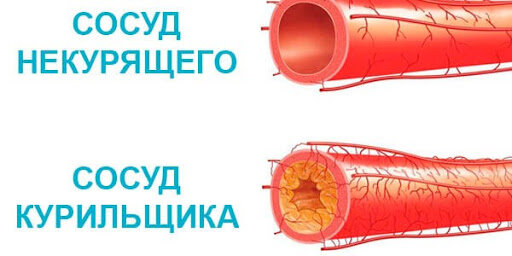 курения и сосуды