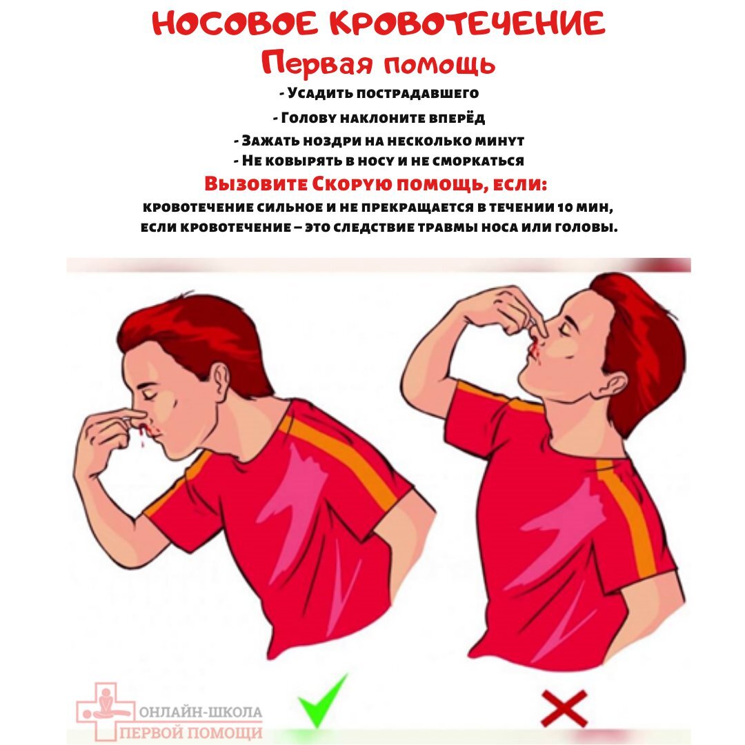 Что делать при носовом кровотечении?