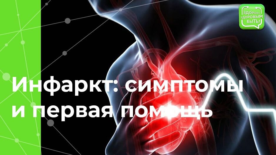 Диагностика и лечение инфаркта миокарда (Сергиев Посад) | Парацельс