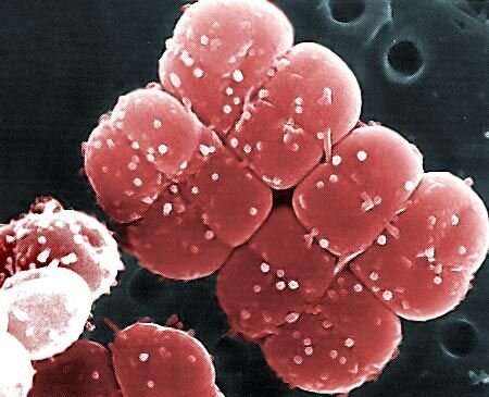 Знакомьтесь, это  Deinococcus radiodurans