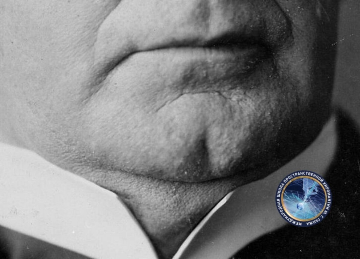 раздвоенный подбородок 