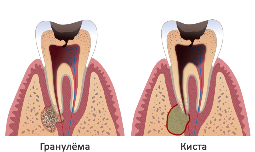 Как избавлялись от зубной боли в старину?