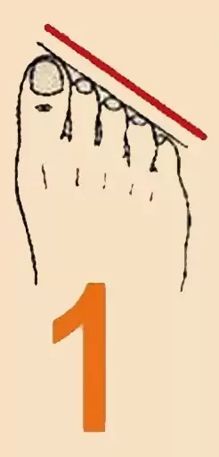 -2