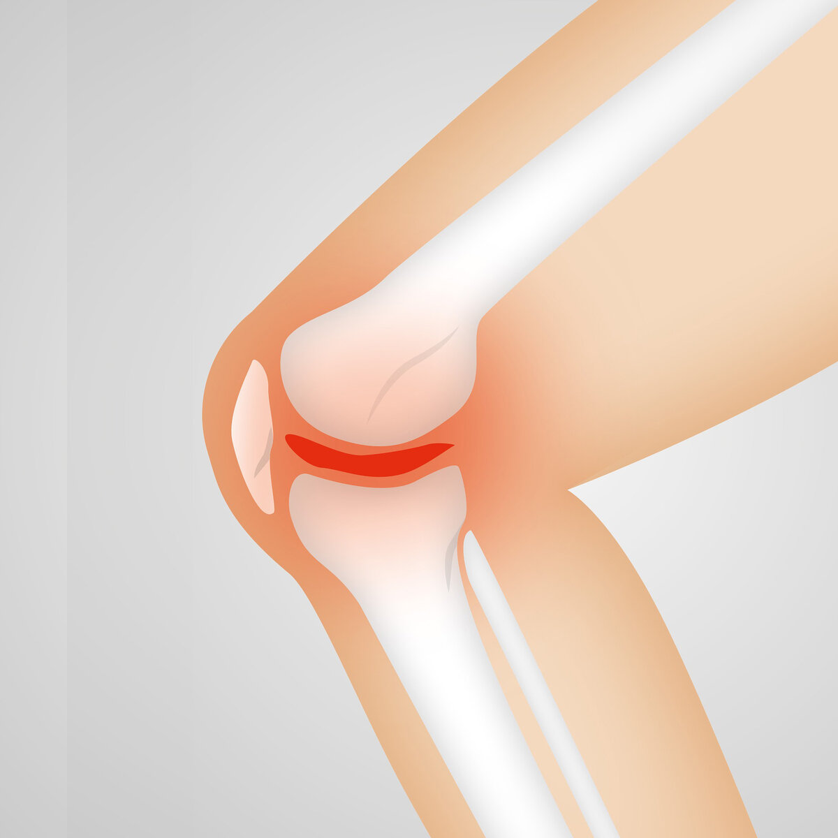 Причины боли в коленях