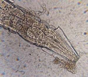 Глисты под микроскопом