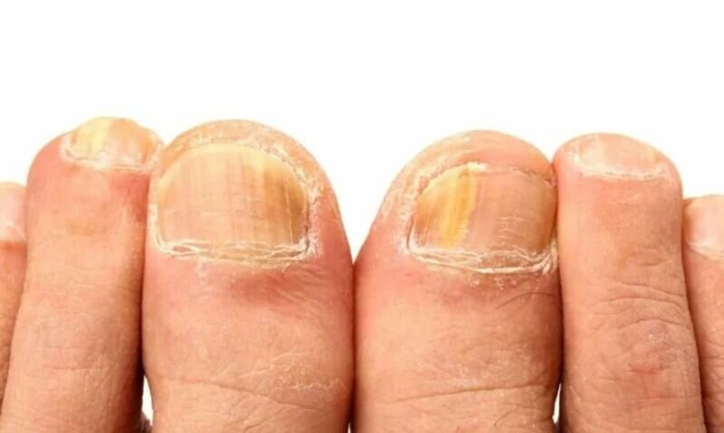 Фото из интернета