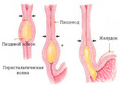 Причины язвы пищевода