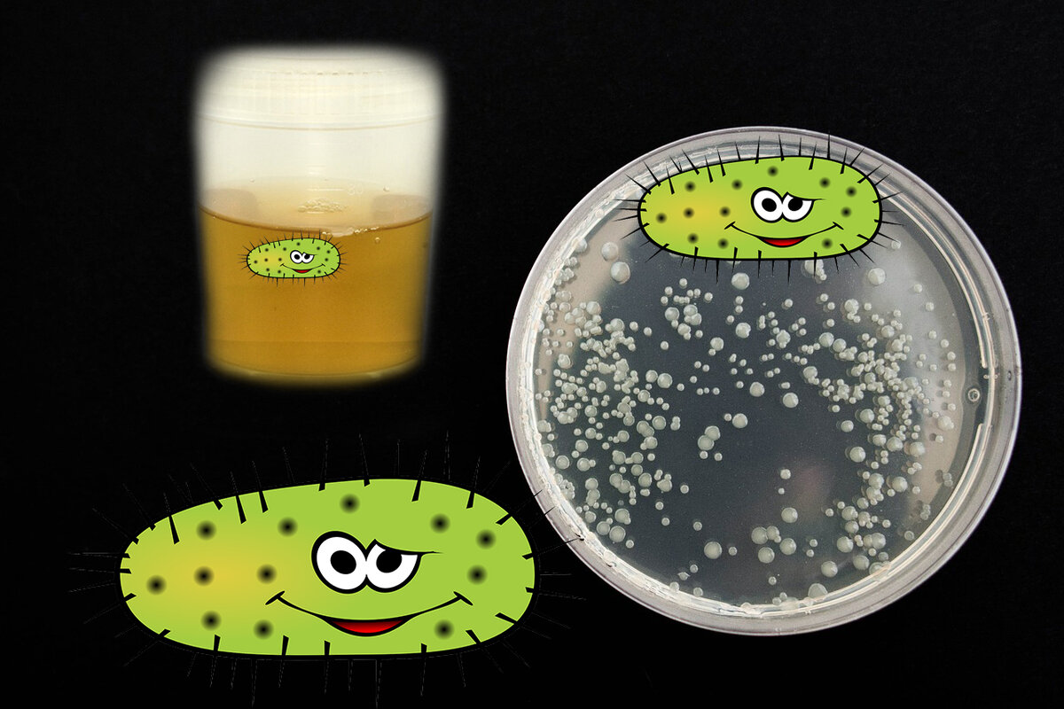 Бактерии в моче