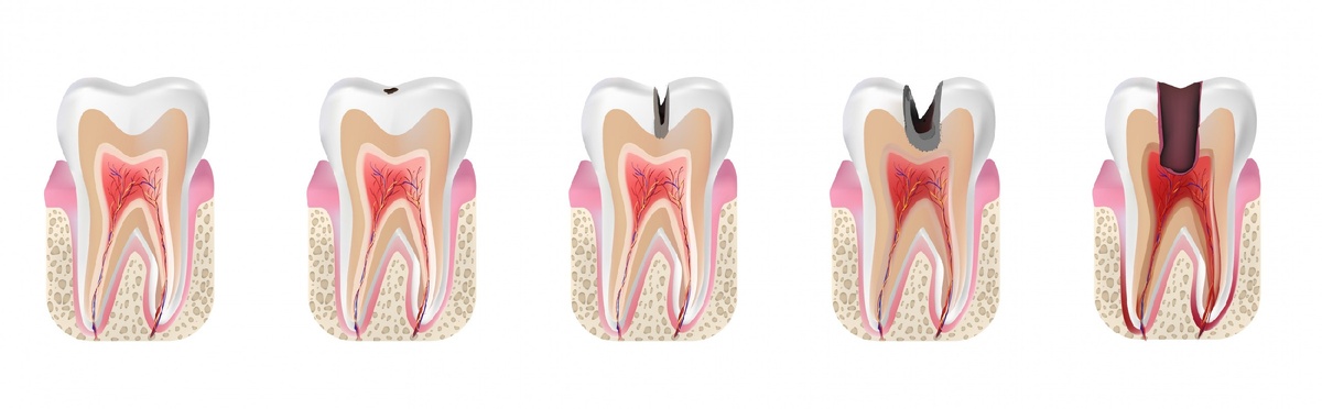 Фото взято из Яндекс Картинок