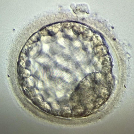 Бластоциста у ребенка. Бластоциста хетчинг. Эмбрион бластоциста. Бластоциста человека гистология. Бластоциста хоминис.