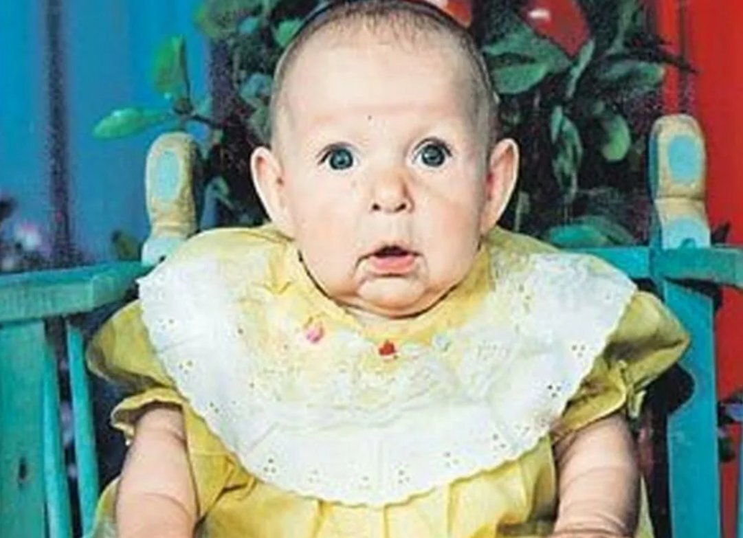 понимаю бабка. прогерия катя неженцева. прогерия екатерина неженцева. прогерия катя неженцева 2019. девочка с лицом бабушки.