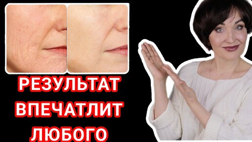 Нашла очень КРУТЫЕ средства. НЕДОРОГИЕ, но невероятно ЭФФЕКТИВНЫЕ ...