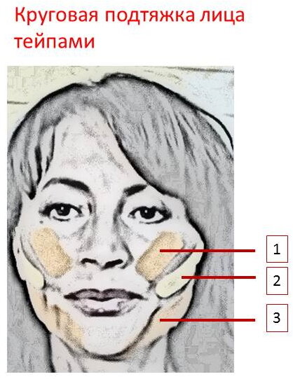 Подтяжка лица тейпами схемы