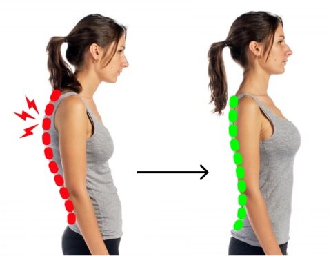 Исправление осанки