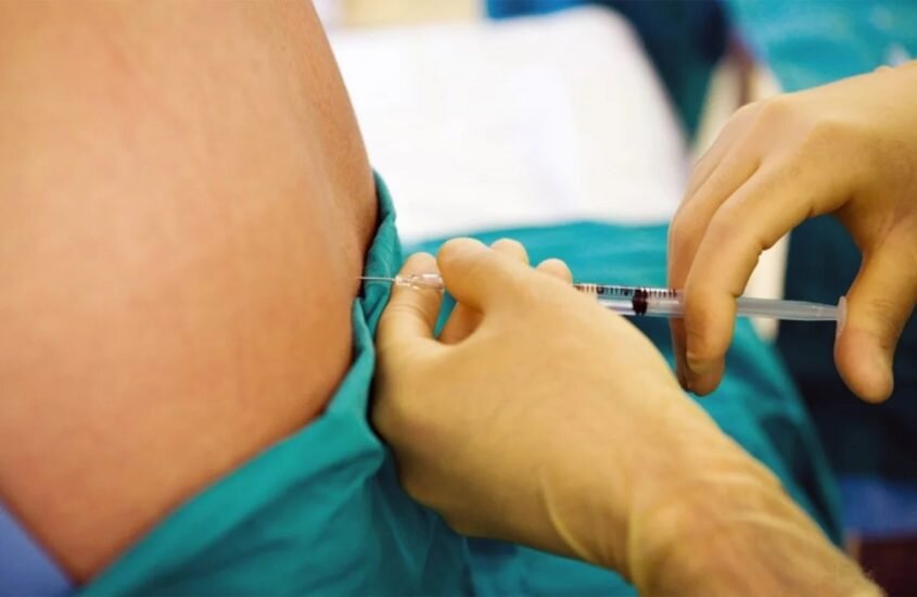 эпидуральная анестезия