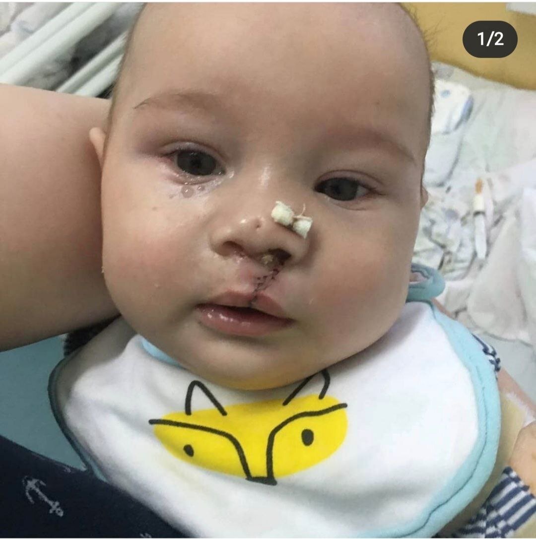 Дима после операции