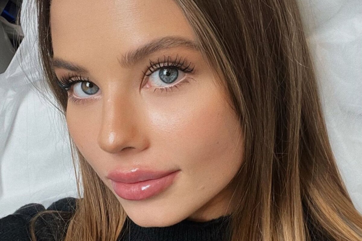     «Мне вообще не больно»: невестка Валерии показала себя до и после увеличения губ