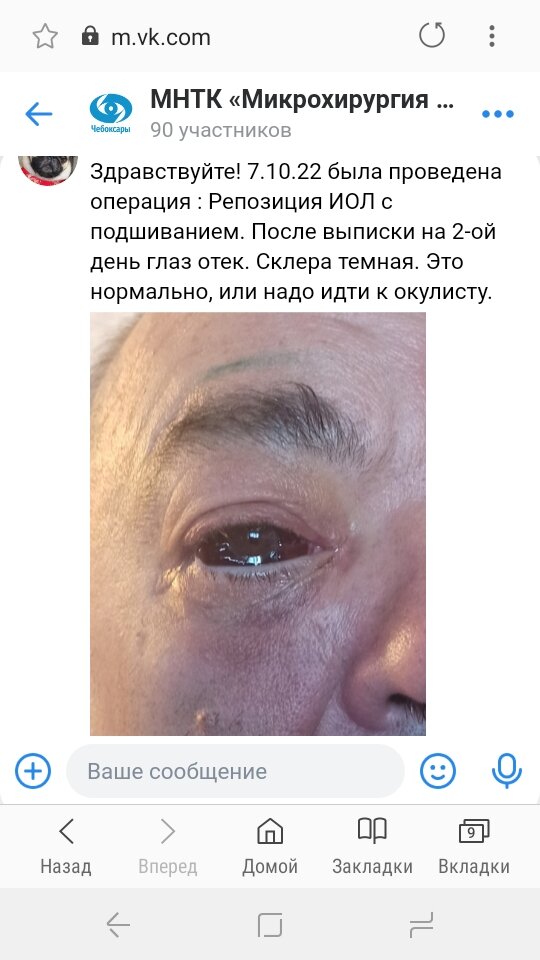 Вот такие "прекрасные глаза" предлагает Центр Федорова