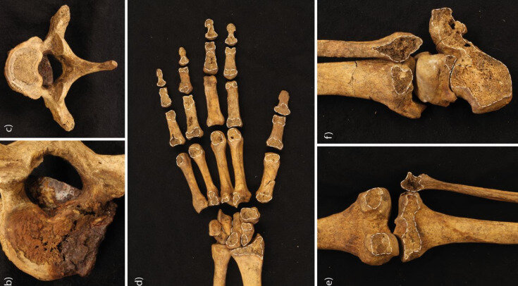   Jonny Geber et al. / International Journal of Osteoarchaeology, 2023